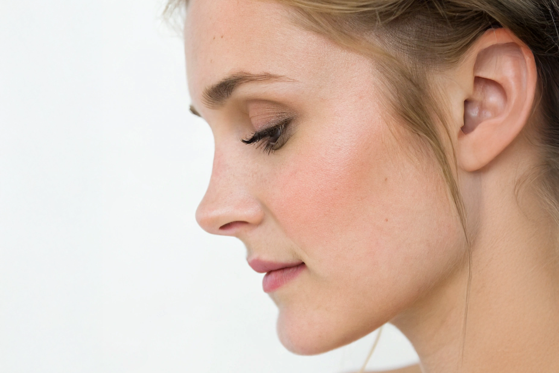 Rhinoplasty indication