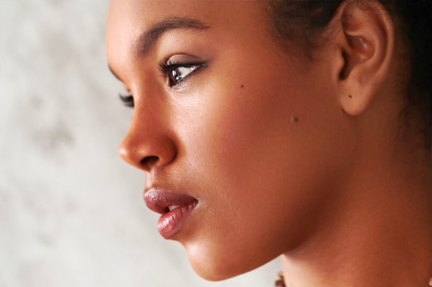 Ethnic rhinoplasty indication — diverse patient profiles, Mexico City